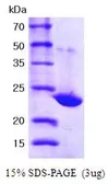 Human PRX I protein, His tag (active). GTX67142-pro
