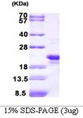 Human PRX II protein (active). GTX67144-pro