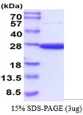 Mouse PRX II protein, His tag (active). GTX67145-pro