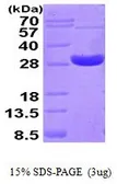 Human PRX IV protein, His tag (active). GTX67147-pro