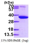 Human PYCR1 protein, His tag (active). GTX67150-pro