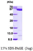 Human Pyruvate Kinase (liver/RBC) protein, His tag (active). GTX67151-pro