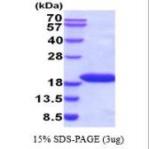 Human SOD1 protein (active). GTX67155-pro