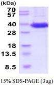 Human Sodium/Potassium ATPase beta 1 protein, His tag (active). GTX67157-pro