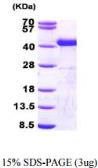 Human Sorbitol Dehydrogenase protein, His tag (active). GTX67159-pro