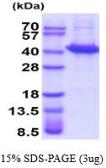 Human Sorbitol Dehydrogenase protein (active). GTX67160-pro