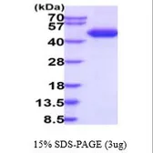 Human ST2 protein, His tag (active). GTX67161-pro