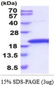 Rat TNF alpha protein, His tag (active). GTX67168-pro