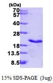 Human TNF beta protein, His tag (active). GTX67169-pro
