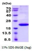 Human TNF beta protein, His tag (active). GTX67170-pro