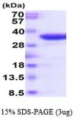Human TRAP protein (active). GTX67173-pro