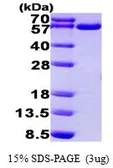 Human TrxR1 protein, His tag (active). GTX67175-pro