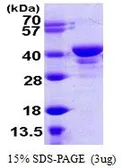 Human UCHL5 protein, His tag (active). GTX67180-pro