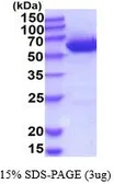 Human UGDH protein, His tag (active). GTX67181-pro