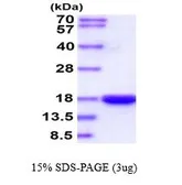 Human IL3 protein, His tag (active). GTX67187-pro