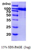 Human Aconitase 1 protein, His tag. GTX67190-pro