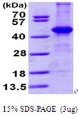 Human Aminoacylase 1 protein, His tag. GTX67191-pro