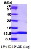 Human ACYP1 protein, His tag. GTX67192-pro