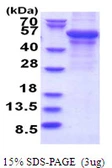 Human ADFP protein, T7 tag. GTX67193-pro