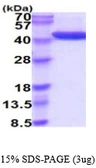 Human Alcohol dehydrogenase 1A protein, His tag. GTX67195-pro