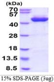 Human Alcohol dehydrogenase 1C protein, His tag. GTX67196-pro
