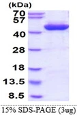 Human Alcohol dehydrogenase 1C protein, His tag. GTX67196-pro