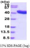 Human Alcohol dehydrogenase 1C protein, His tag. GTX67197-pro