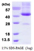 Human ADH6 protein, His tag. GTX67199-pro