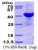 Human ADPRH protein, His tag. GTX67200-pro