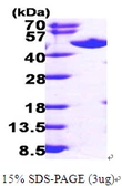 Human AHCY protein, His tag. GTX67203-pro