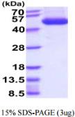 Human AHCY protein, His tag. GTX67204-pro