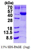 Human ALAD protein, His tag. GTX67208-pro