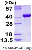 Human Aldolase B protein, His tag. GTX67210-pro