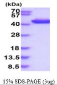 Human Aldolase C protein, His tag. GTX67211-pro