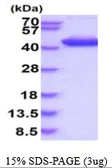 Human Aldolase C protein, His tag. GTX67211-pro