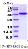 Human Aldolase C protein. GTX67212-pro