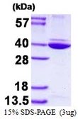 Human Annexin A8 like 2 protein, His tag. GTX67213-pro
