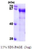 Human BIN1 protein, His tag. GTX67214-pro