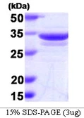 Human Annexin A1 protein. GTX67215-pro