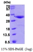Human Annexin IV protein. GTX67218-pro