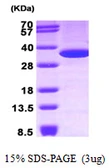 Human Annexin V protein. GTX67219-pro
