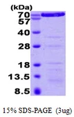 Human Annexin VI protein, His tag. GTX67220-pro