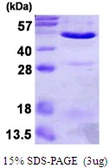 Human Annexin VII protein, His tag. GTX67221-pro