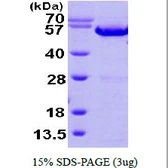 Human Annexin XI protein, His tag. GTX67222-pro