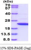Human APRT protein. GTX67227-pro