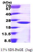 Human ARF1 protein, His tag. GTX67228-pro