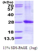 Human ARL4D protein, His tag. GTX67231-pro