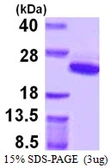 Human ARF5 protein, His tag. GTX67232-pro