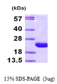 Human ARF6 protein, His tag. GTX67233-pro