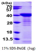 Human Arginase 1 protein, His tag. GTX67234-pro